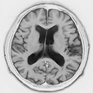 MRI画像01